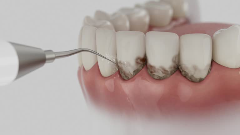 Trusted Wisdom Tooth Removal service in Noel, MO - Dentist Open Now
